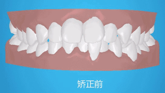 170558gg37xv9bvd3vdzdj.gif