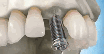 170558l4g1h5f877t22bzg.gif
