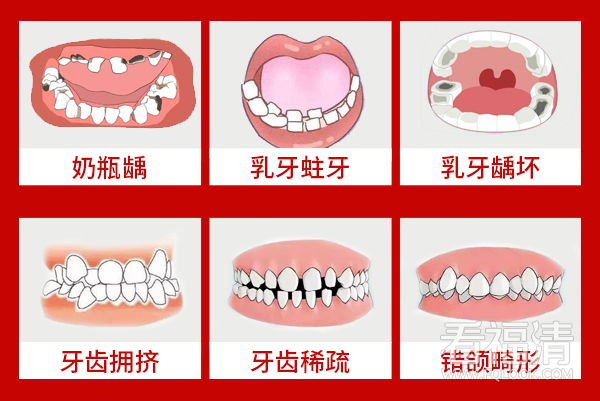 170559nr1t1t20qpe1zf9u.png