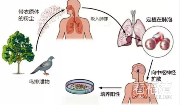 150027y78kg625616l5g61.png