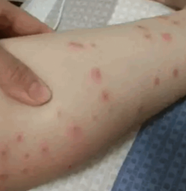 085146g1nuwzizwnp6wppp.gif