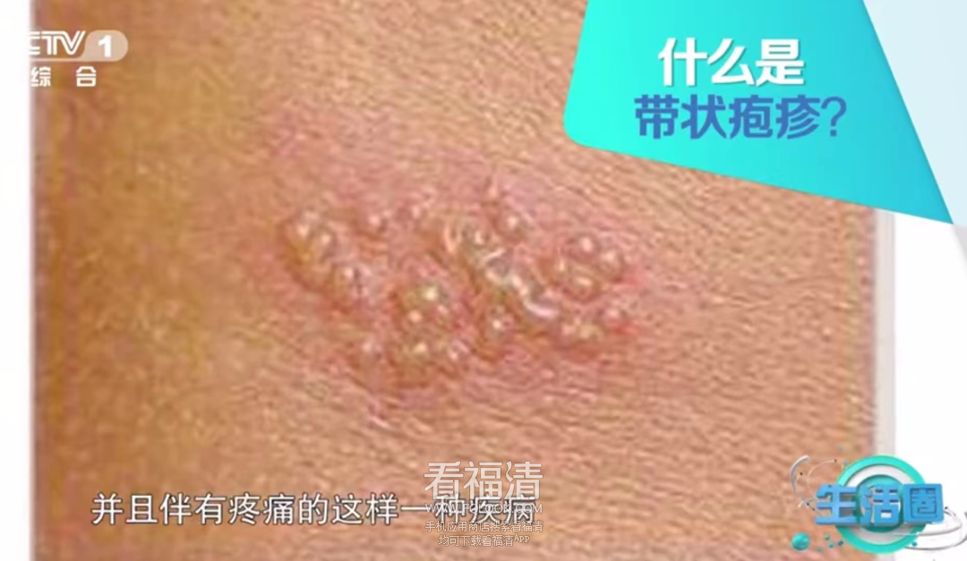 090438jn5rpoz8858886t6.png