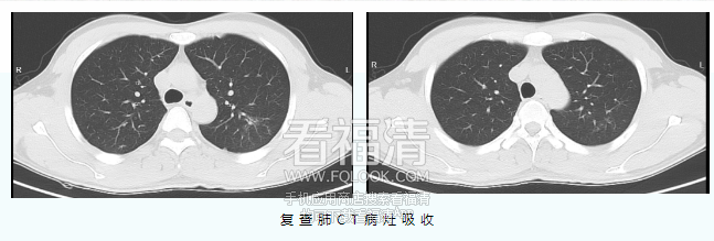 093013bdsvmguhgcv59uj6.png
