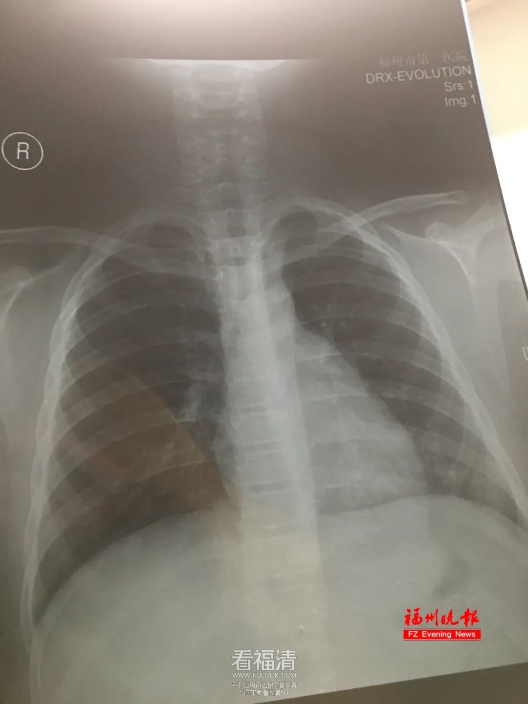 090051bpt66v7b3vo711rb.jpeg