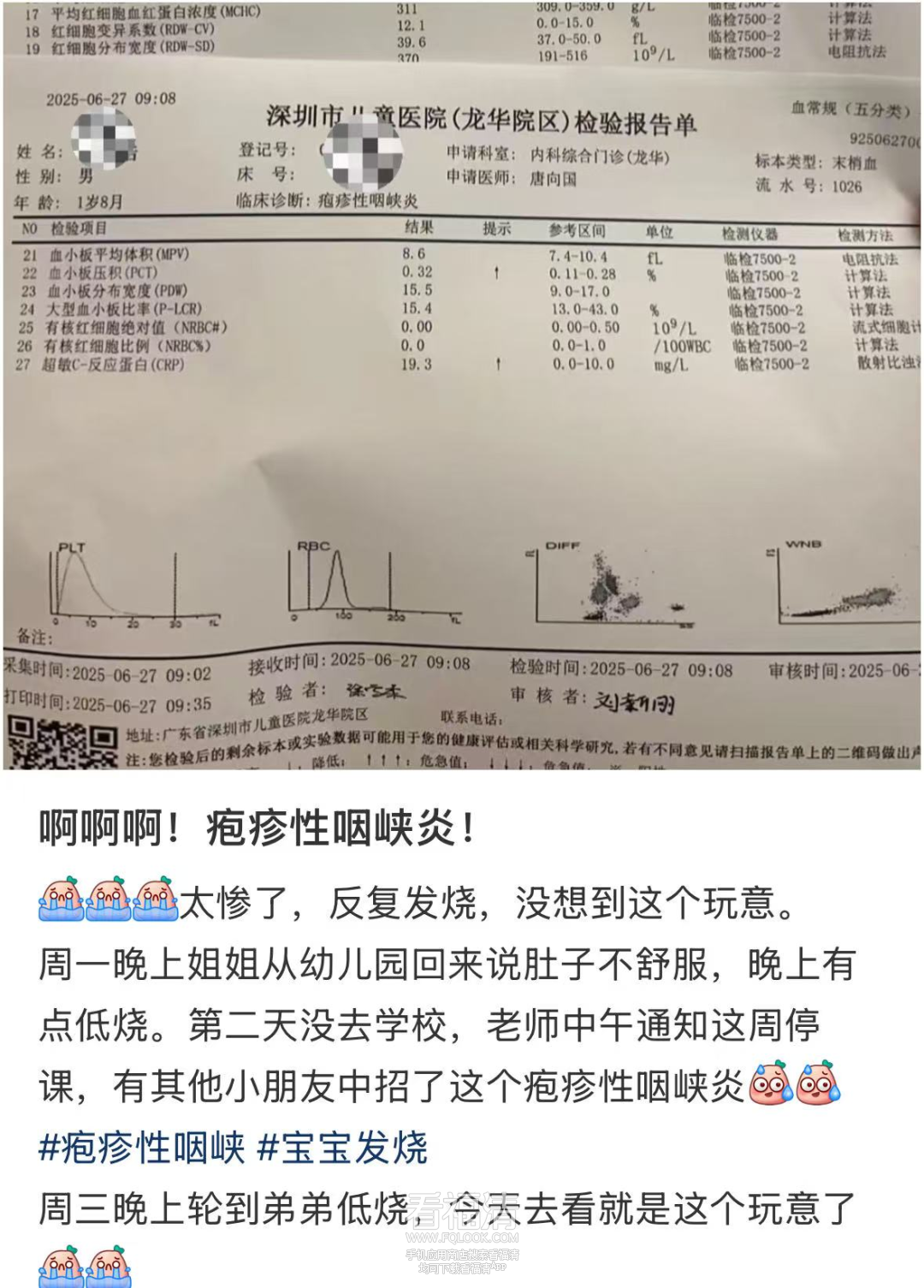090309qunlmye0xkrn5mku.png