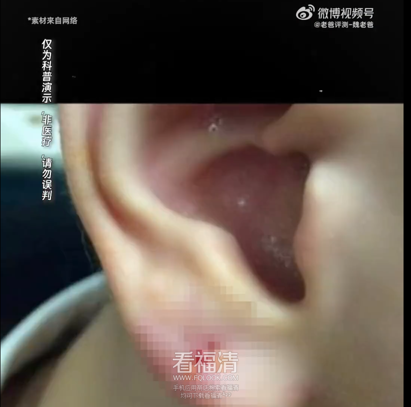 091755lq1vwm53w3nzkv7v.png